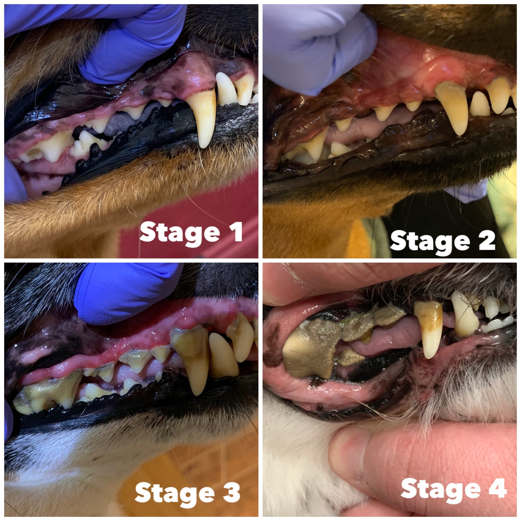 teeth disease